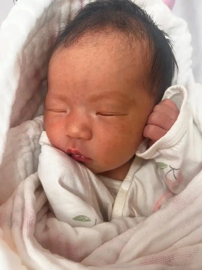 新生儿黄疸 泡芙出生第二天黄疸值就13 了, - 抖音