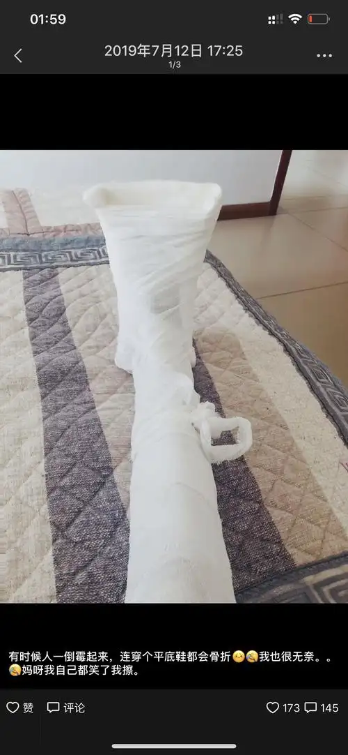 我再说一遍我这个腿是骨折骨折不是截肢啊