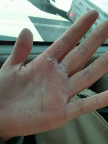 伤痕累累的手掌