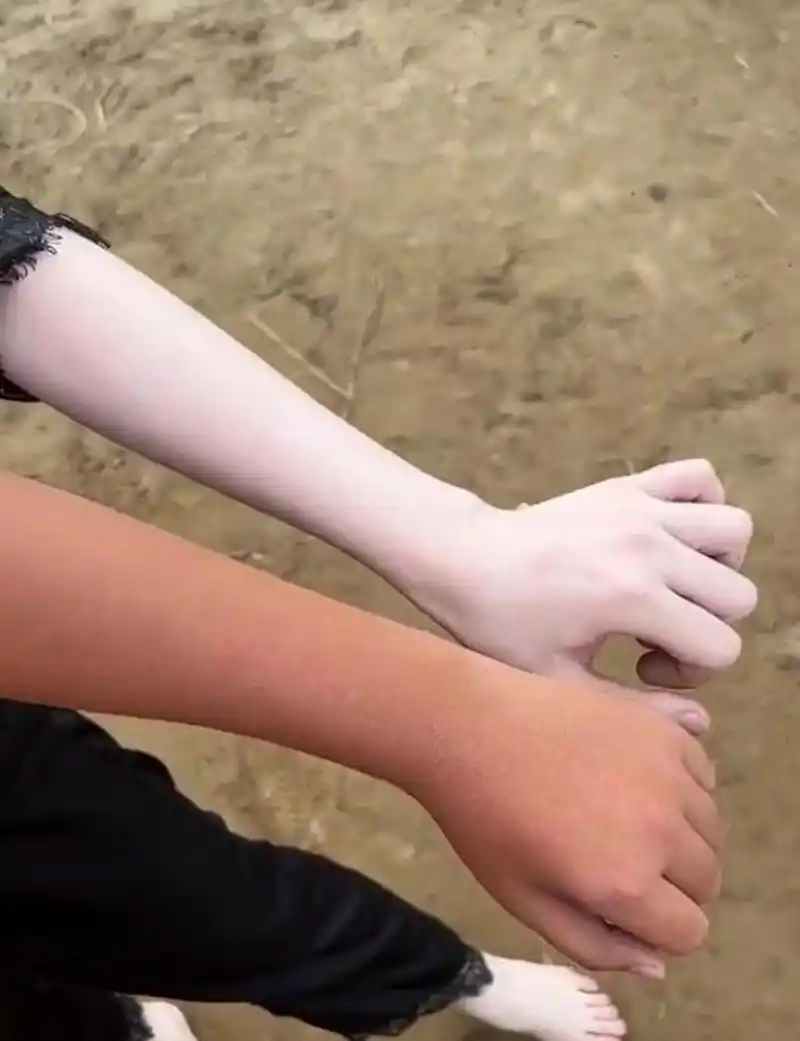 这种肤色正常吗!