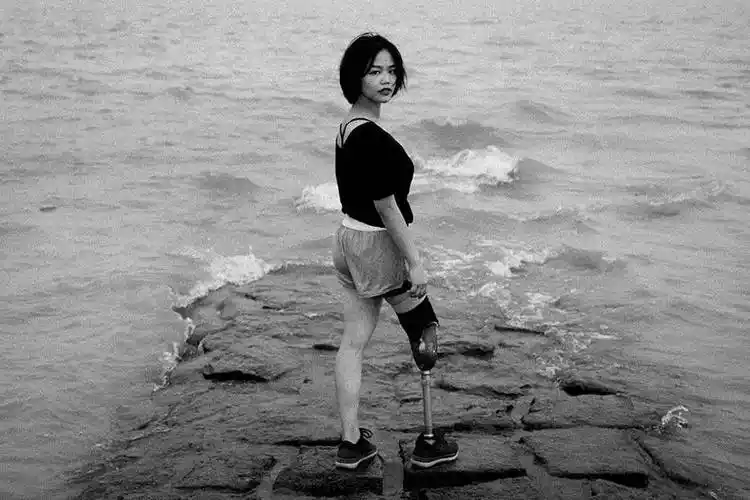 95后独腿女孩:用"坚强"来当另一条腿 - 专题 - 中华善德网