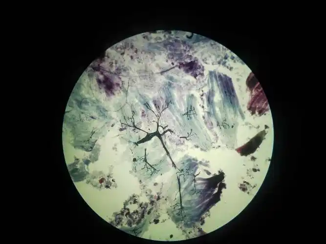 显微镜下的运动终板