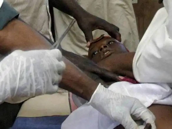 割礼是什么意思(割礼是什么意思图片 效果图)-手指套