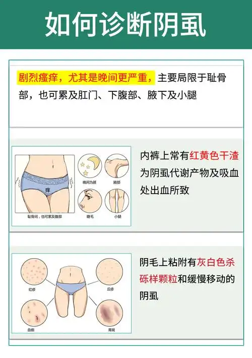 阴虱男私处用10硫磺软膏去虱子乳膏百部酊喷雾林ld旦乳膏孕妇女用祛除