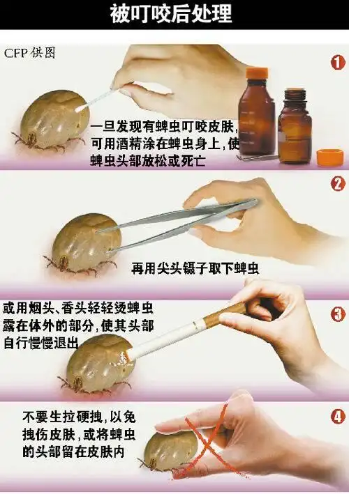 小雨浮尘 采纳数:74获赞数:295lv7               追问 问题是狗