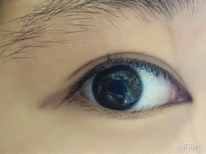 拥有一双清澈的眼睛是种什么体验