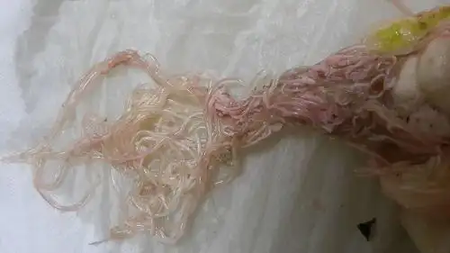 鱿鱼肚子里粉红色细丝状软软的一团的是什么?可以吃吗?