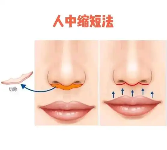 香唇和人中好看真的超能散发女性魅力