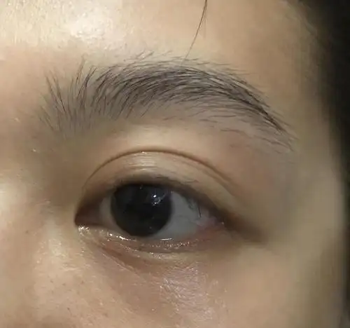 26岁的眼下细纹 要哭了