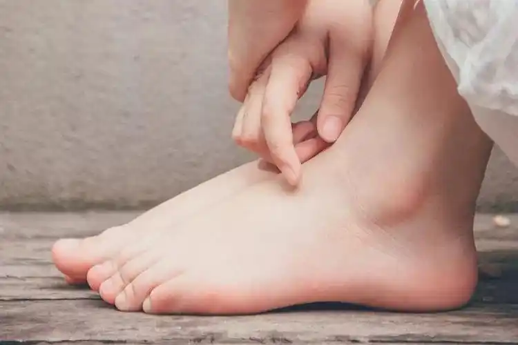 这个部位一到冬天就干裂起皮女生都会忽略的死角你注意到了吗