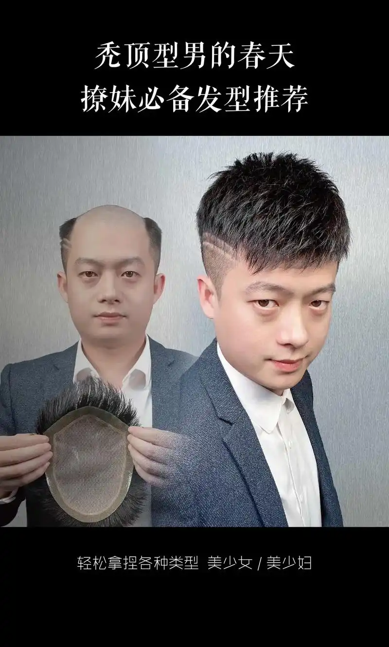 型男9099秃顶9099必备发型推荐!