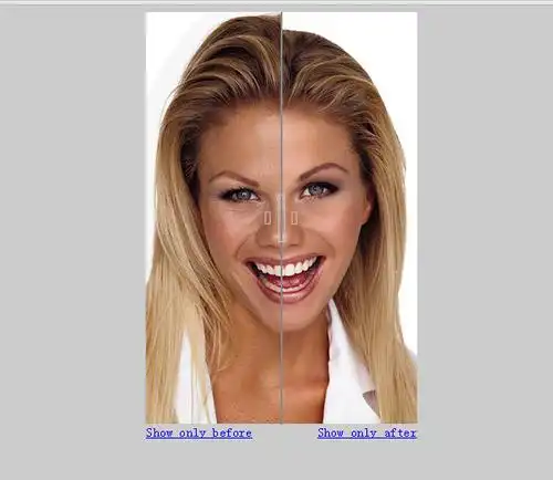 before-after左右拖拽分隔条对比图片效果