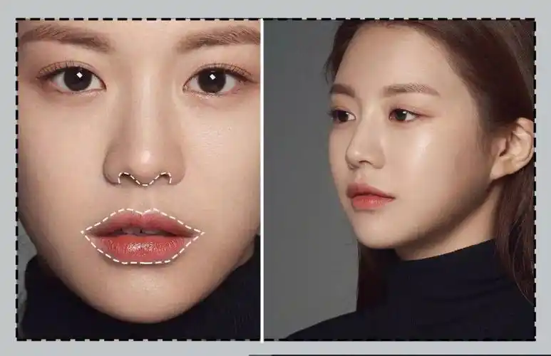 神仙换头丨曾因太丑被霸凌?而今成"整形模板"!