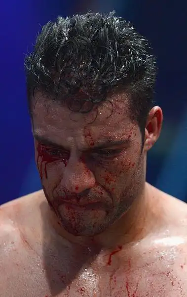 图文大克里琴科卫冕wbc金腰带查尔脸上血迹