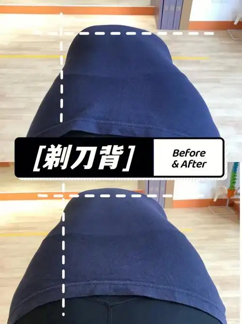 剃刀背你有了解过吗71