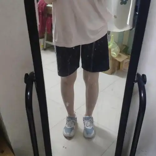 我这种腿型是正常的吗