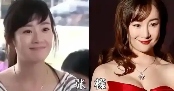 张檬:因为爱情,"毁掉"了整个演艺生涯,美人真该远"整容"