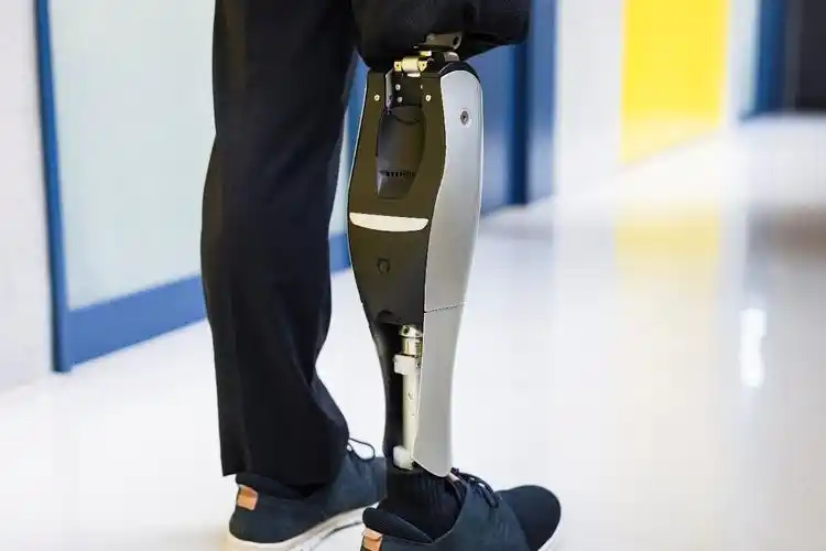 装配假肢有哪些原则?