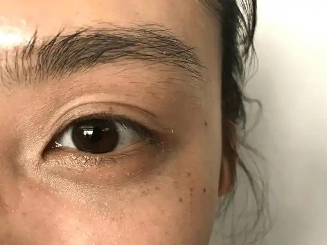 不用昂贵眼霜,也能彻底告别黑眼圈!