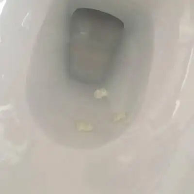 今天上厕所时阴道流出一些乳白色黏稠分泌物 正常吗?有点味道.