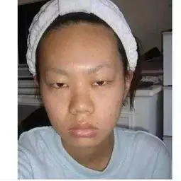 丑女头像真实点的胖小眼睛