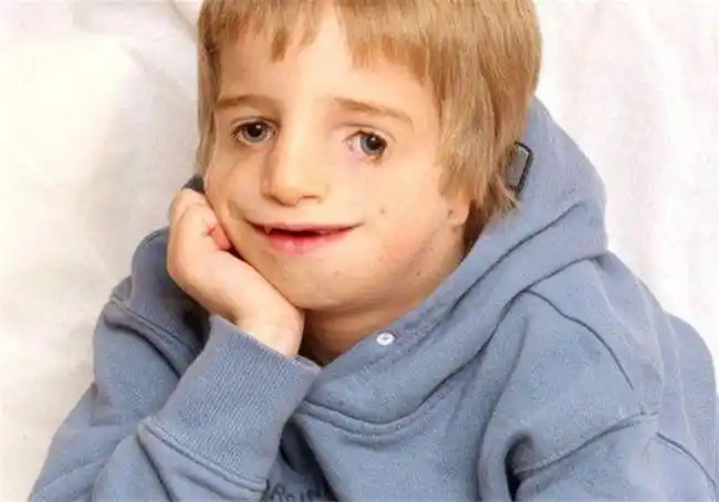 英国小伙面目畸形,靠真心娶到美女妻子,孩子产下后两人笑容消失了