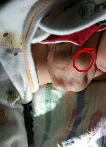 基隆市疝专家_基隆市治疗疝哪个专家好_基隆市治疗疝