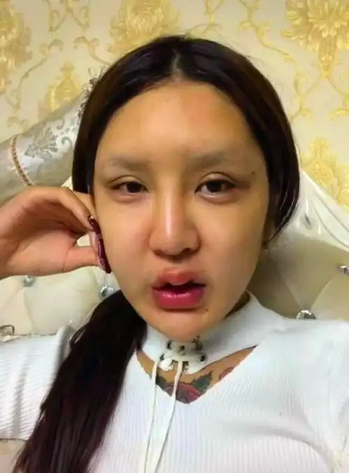 这个女孩曾表示自己的这张脸价值85万,自己前前后后整容无数次,连自己