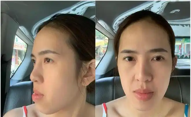 场外表带来的"人情冷暖",她此前一直因下巴过长遭到丈夫的歧视和嘲笑