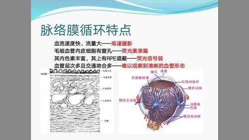 关于脉络膜造影