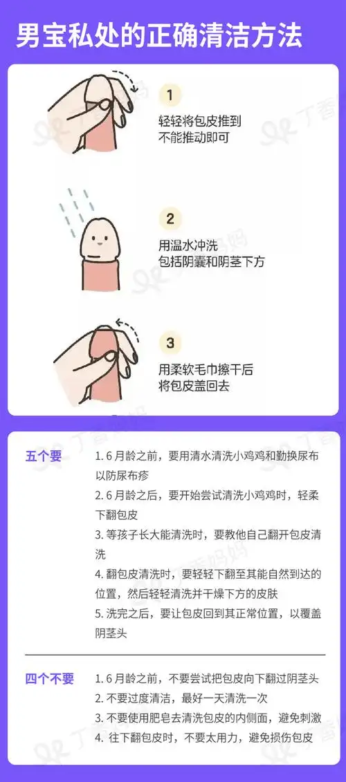 uptodate临床顾问[2] 儿童和青少年龟头炎和龟头包皮炎的临床表现