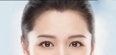 种植美人尖好看/深圳美人尖