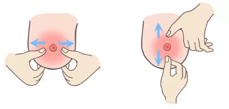 乳头凹陷怎么喂奶