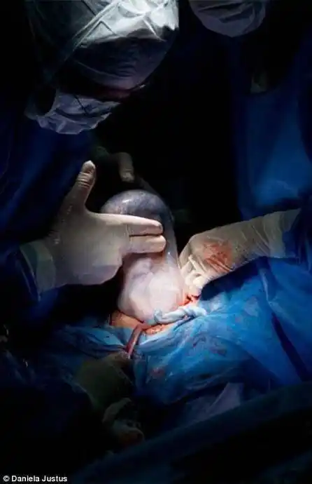 女人是怎么生孩子的?看过这些图的男人都哭了