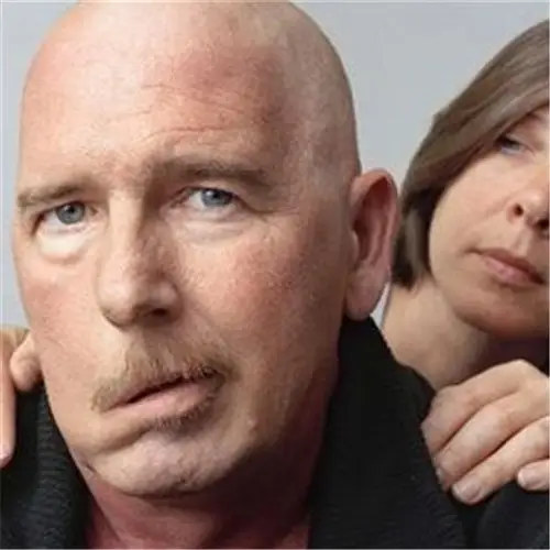 面部神经炎表现图片