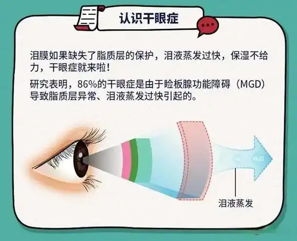 真奥眼镜#科普 #保护眼睛从我做起 认识干眼症 - 抖音