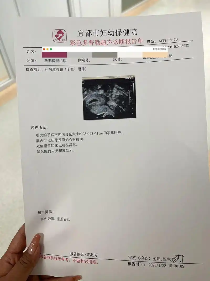 大家6周孕囊多大呀? 孕妈妈6周的时候,孕囊多大?有没有可能双胞胎?