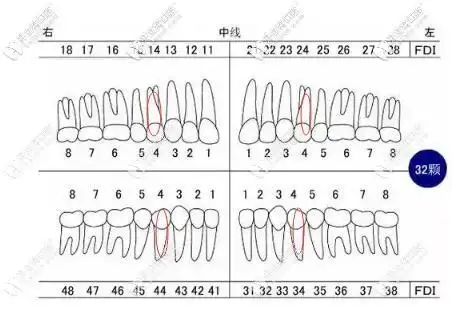 具体拔智齿磨牙远移好还是拔4号牙,要看我们牙齿需要多少的内收量