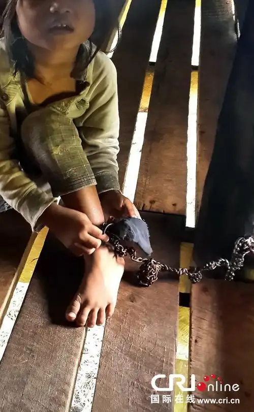 哥伦比亚4岁女孩被养母用铁链"囚禁"2年获救(高清组图)