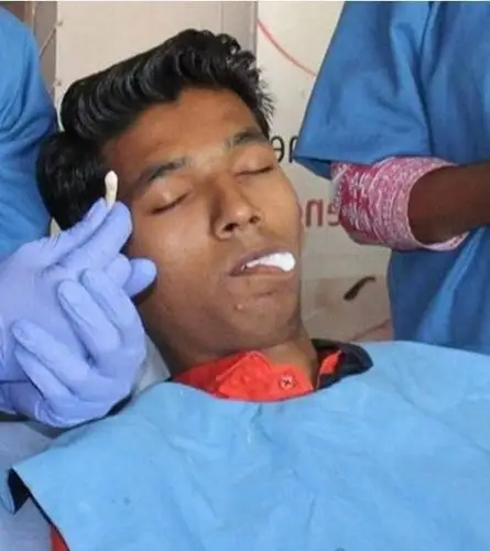 世界上牙齿最长的人长17厘米的巨牙是假新闻最长367cm