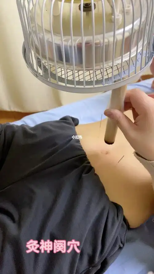 腹痛腹泻小腹凉古法艾灸最适宜艾灸神阕穴针刺天枢穴