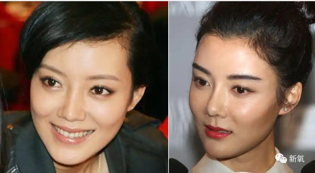 这是我见过最敢的女星,猪鼻子还能演美女?|假体|鼻头|车晓_新浪新闻