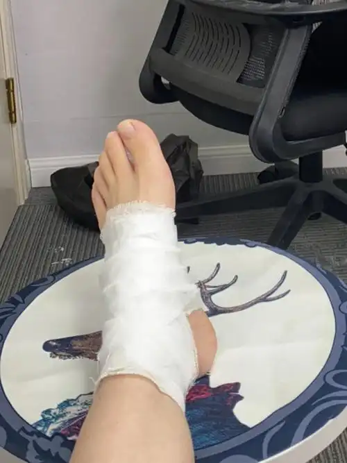 跳舞时怎样避免关节和腰部受伤?