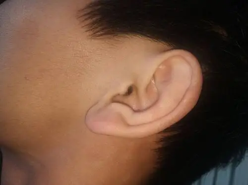 这样的耳朵都说没福气是么