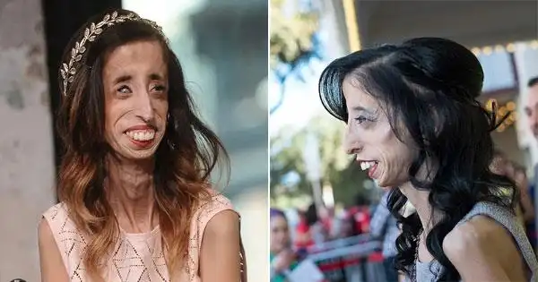 她曾被讥讽是「世界上最丑的女人」要她赶快自杀,结果面对这些霸凌她