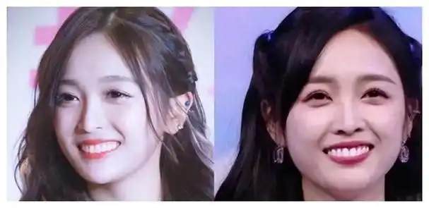 尴尬不堪,笑料百出|牙齿|张天爱|吴宣仪|扑哧君|迪丽热巴_网易订阅