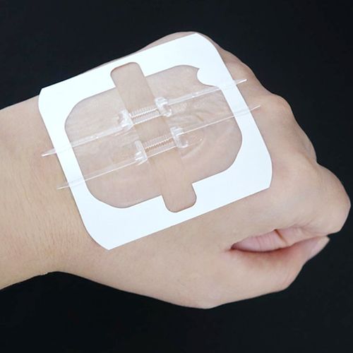 医用缝胶带拉链式创口贴皮肤伤口减张贴拉合缝合贴缝针减张器问德堂