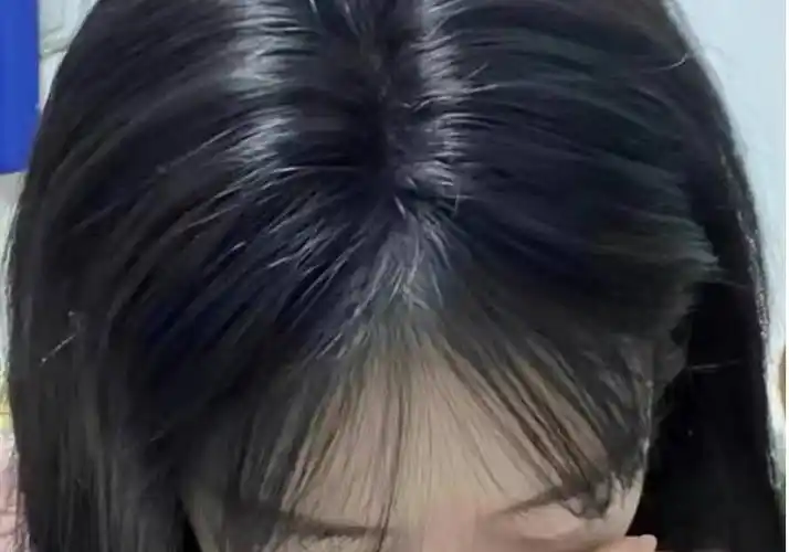 脱发有救了!3个方法让你拥有浓密发量!建议收藏!_头发_头顶_效果