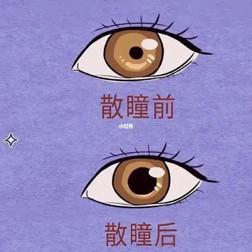 散瞳前后对比