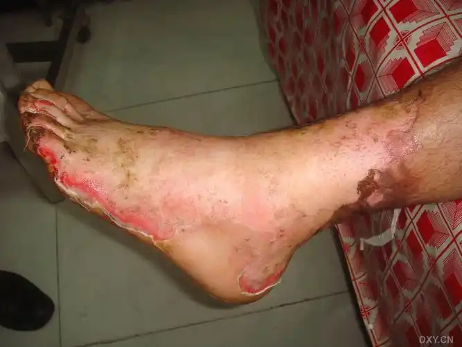 切换新版 >> 不再显示 ×